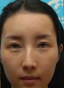 全面解析18❌❌❌有直套官方免费版的最新动态